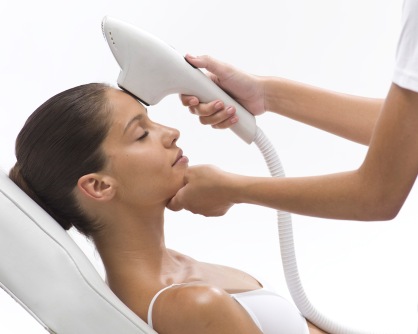 Laser acne removal with an IPL device