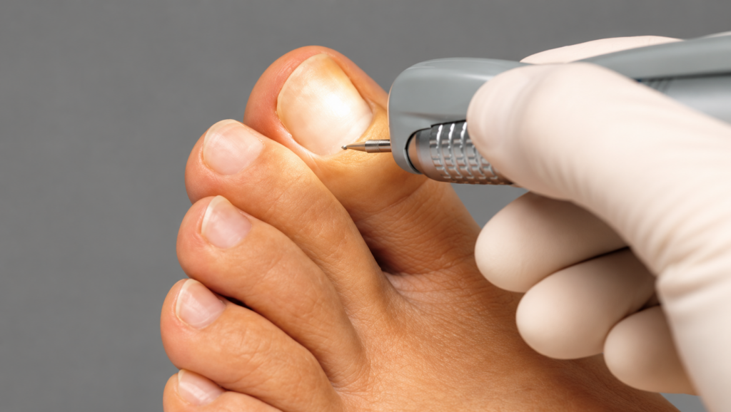 Instrumental pedicure for men – GERLACH TECHNIK (Germany)