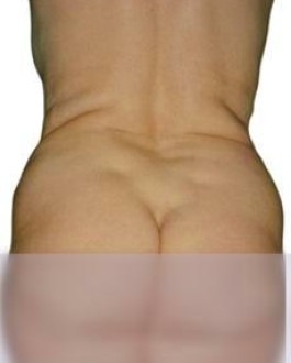 Před