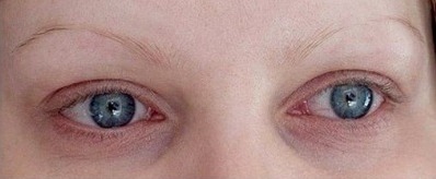 Před – microblading