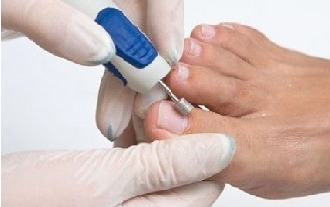 Instrumental pedicure for men – GERLACH TECHNIK (Germany)