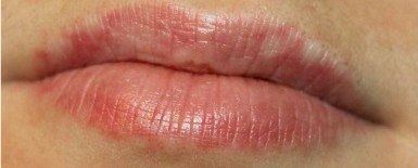 Před – permanentní make-up rtů