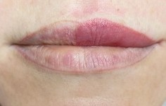 Před – permanentní make-up rtů