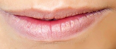 Před – permanentní make-up rtů