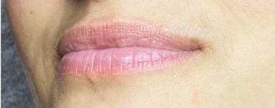 Před – permanentní make-up rtů