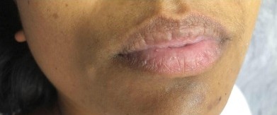 Před – 3D make-up rtů