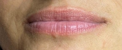 Před – 3D make-up rtů