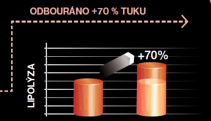 Endermologie results